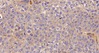 Unveiling the impact of C15orf48 on non-small cell lung cancer through NF-kappa B signaling