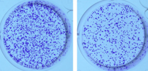 Quercetin regulates sensitivity to X-ray radiation of hepatocellular carcinoma through miR-216a-3p