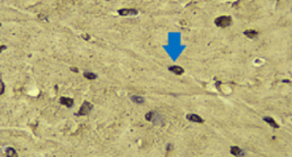 Piezo1-driven mechanotransduction as a key regulator of cartilage degradation in early osteoarthritis