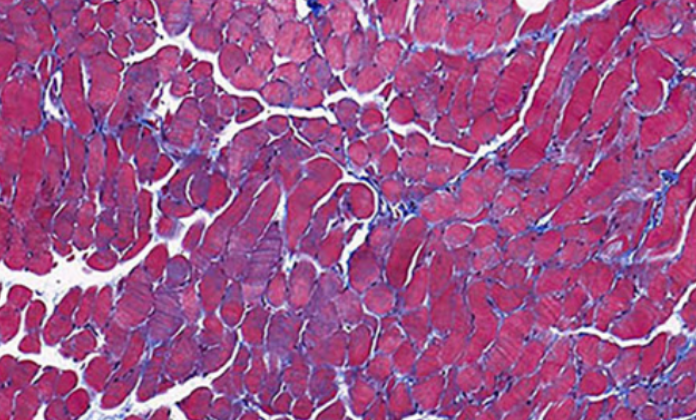 Therapeutic potential of simvastatin in ALS: Enhanced axonal integrity and motor neuron survival through Apoa4 and Alb modulation