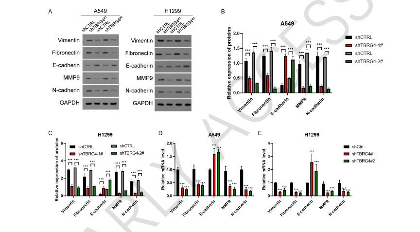 TBRG4 as a prognostic biomarker and key regulator of cell cycle and EMT in lung cancer
