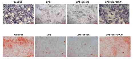 Silencing FOXA1 suppresses inflammation caused by LPS and promotes osteogenic differentiation of periodontal ligament stem cells through the TLR4/MyD88/NF-κB pathway