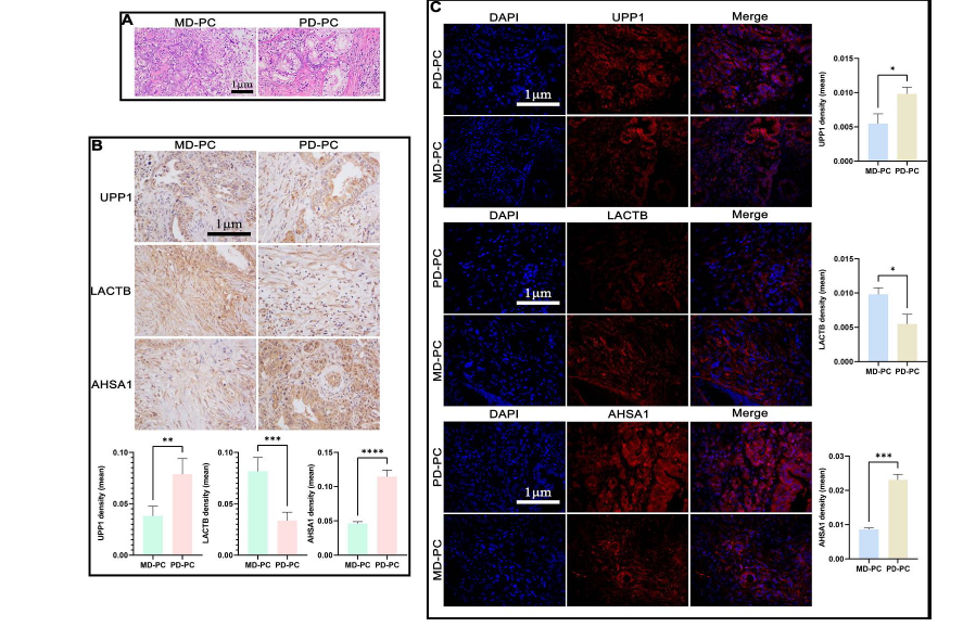 UPP1 and AHSA1 as emerging biomarkers and targets in pancreatic cancer: A proteomic approach