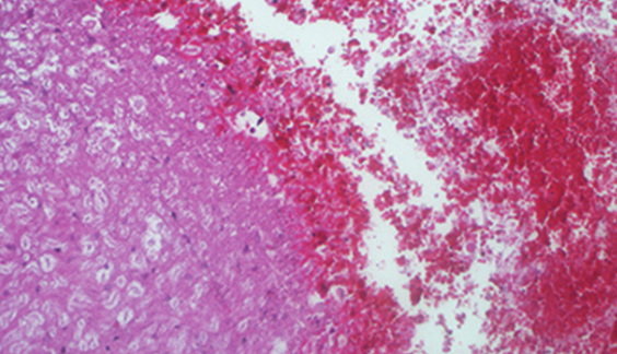 Neuroprotective effects of sildenafil in experimental spinal cord injury in rabbits