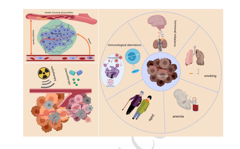 Tumor hypoxia: Classification, detection, and its critical role in cancer progression