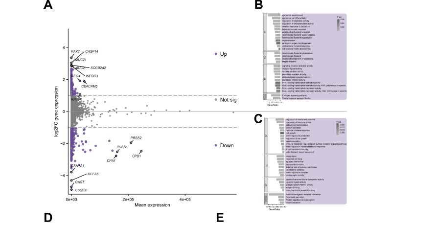 WFDC3 identified as a prognostic and immune biomarker in pancreatic cancer