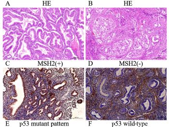 Molecular classification and fertility-sparing outcomes in endometrial cancer and atypical endometrial hyperplasia