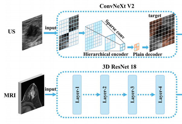 Deep learning predicts HER2 status in invasive breast cancer from multimodal ultrasound and MRI
