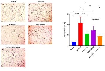 TUDCA combined with Syndopa protects the midbrain and gut from MPTP toxicity in a Parkinson’s Disease mouse model: Immunohistochemical evidence