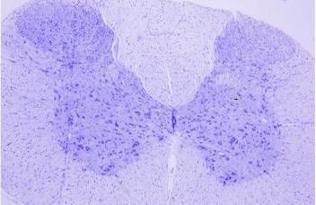 Melatonin and omega-3 neuroprotection in prenatal rat spinal cord exposed to 900 MHz electromagnetic field