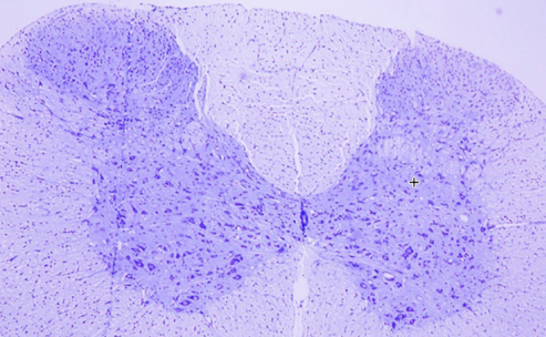 Melatonin and omega-3 neuroprotection in prenatal rat spinal cord exposed to 900 MHz electromagnetic field