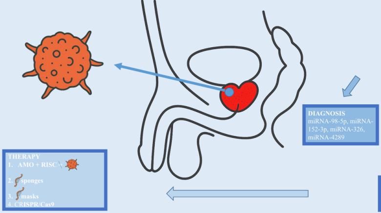 Circulating microRNAs in prostate cancer — non-invasive biomarkers for diagnosis, prognosis and therapy: A review