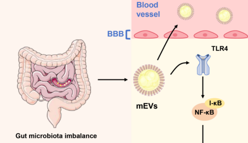 Gut microbiota-derived extracellular vesicles in Alzheimer’s disease – Immunomodulatory mechanisms, biomarkers, and therapeutic opportunities: A review