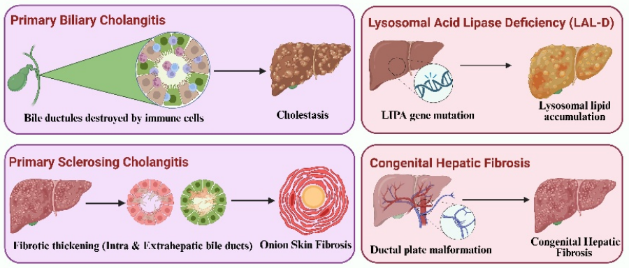 Rare liver diseases — Etiology, diagnosis and management: A review