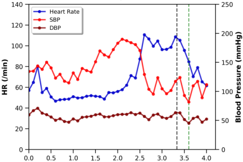 Dantrolene use across surgical and medical care at Mayo Clinic from 2010 to 2024: Indications, frequency, and value for identifying malignant hyperthermia
