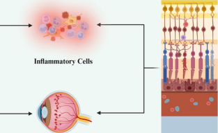 Stem cell–based therapies for inherited retinal diseases – Translational advances and clinical evidence: A review