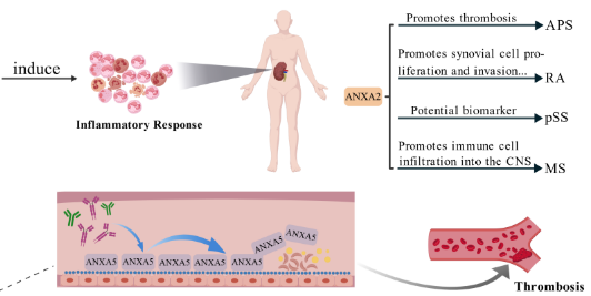 Annexins and autoantibodies in autoimmune diseases – Insights into SLE, APS and RA: A review