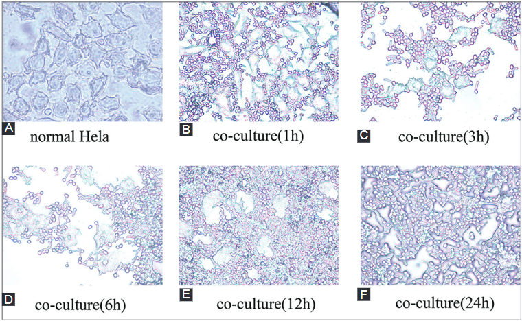 Time course of global gene expression alterations in Candida albicans during infection of HeLa cells
