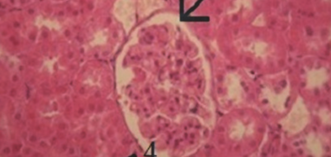 Eucalyptus globulus extract protects upon acetaminophen-induced kidney damages in male rat