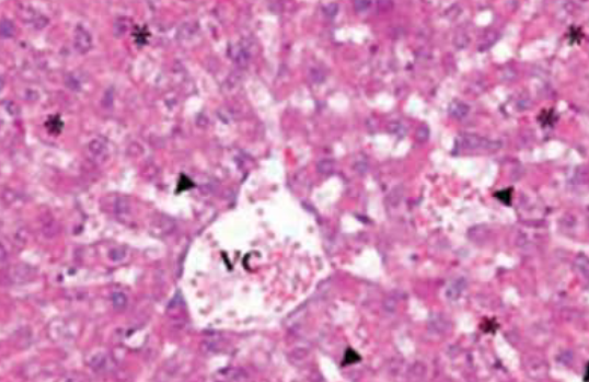 The protective effect of diosmin on hepatic ischemia reperfusion injury: an experimental study