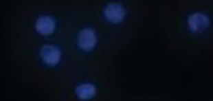 Activation of M1 mAChRs by lesatropane rescues glutamate neurotoxicity in PC12 cells via PKC-mediated phosphorylation of ERK1/2