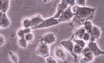 Induction of apoptosis by grape seed extract (Vitis vinifera) in oral squamous cell carcinoma