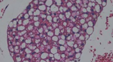 Hypolipidemic and antioxidant effects of buckwheat leaf and flower mixture in hyperlipidemic rats