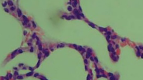 Low molecular weight heparin prevents CLP-Induced acute lung injury in rats by anti-inflammatory coagulation