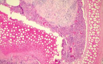 The effect of subcutaneous Insulin-like Growth Factor-1 (IGF-1) injection on rabbit auricular cartilage autograft viability