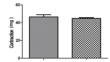 Contractile responses of urinary bladder in an experimental model of chronic renal failure