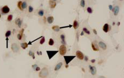 The effects of Crataegus aronia var. dentata Browicz extract on biochemical indices and apoptosis in partially hepatectomized liver in rats
