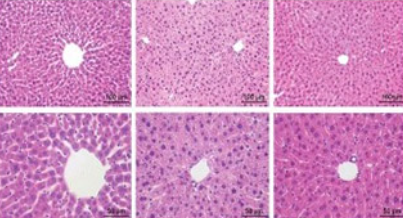 Isoflurane and postoperative respiratory depression following laparoscopic surgery: A retrospective propensity-matched analysis