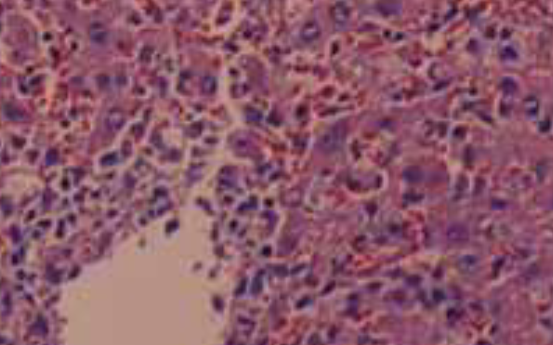 The hepatic protective mechanism of Ginkgo biloba extract in rats with obstructive jaundice