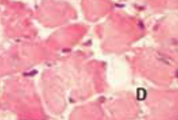 Heart-type fatty acid-binding protein and its relation with morphological changes in rat myocardial damage model induced by isoproterenol