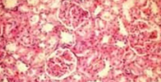 The effects of tadalafil on renal ischemia reperfusion injury: an experimental study