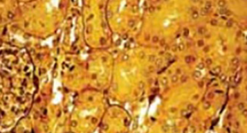 Pentoxifylline Ameliorates Glomerular Basement Membrane Ultrastructural Changes Caused by Gentamicin Administration in Rats