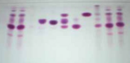 Identification and Isolation of Pharmacologically Active Triterpenes in Betuale Cortex, Betula Pendula Roth., Betulaceae