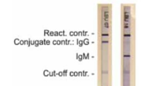 Sandfly – Pappataci Fever in Bosnia and Herzegovina: The new-old Disease