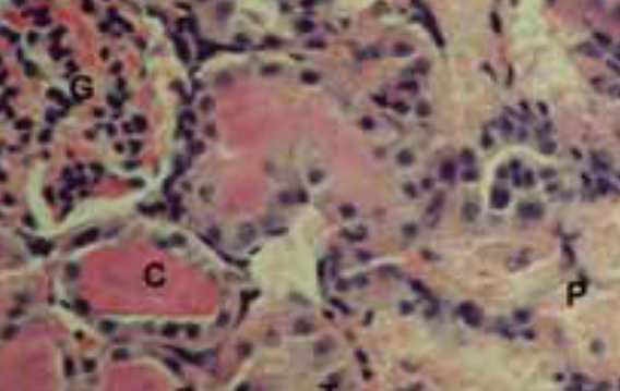 The Effects of Inducible Nitric Oxide Synthase Inhibitor L-N6-(1-Iminoethyl) Lysine in Gentamicin-Induced Acute Tubular Necrosis in Rats