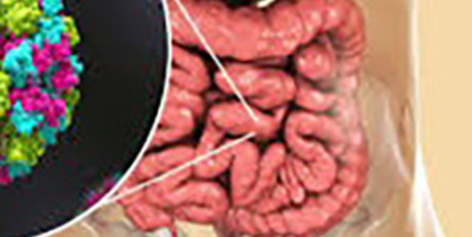 Causal Factors of Acute Gastroenteritis in Infants and Young Children