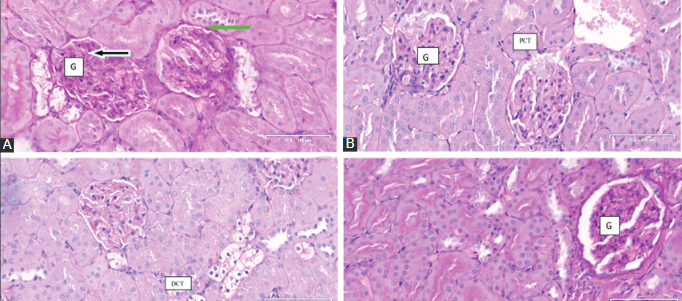 Histological and biochemical effects of Cinnamomum cassia nanoparticles in kidneys of diabetic Sprague-Dawley rats