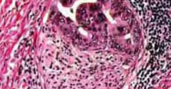 Experimental model of the burn wound topical treatment