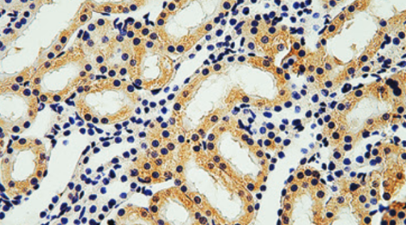 Dihydromyricetin promotes autophagy and attenuates renal interstitial fibrosis by regulating miR-155-5p/PTEN signaling in diabetic nephropathy