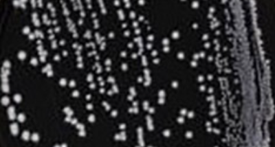 Human brucellosis in pregnancy – an overview