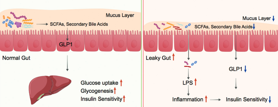 Reconstruction of intestinal microecology of type 2 diabetes by fecal microbiota transplantation: Why and how