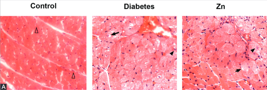 Effect and mechanisms of zinc supplementation in protecting against diabetic cardiomyopathy in a rat model of type 2 diabetes