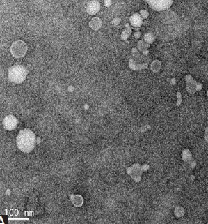 Plasma exosome-derived fragile-site associated tumor suppressor is a powerful predictor of prognosis in patients with ovarian cancer