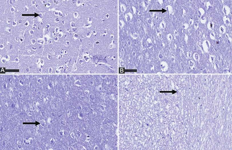 Tenofovir-silver nanoparticles conjugate ameliorates neurocognitive disorders and protects ultrastructural and cytoarchitectonic properties of the prefrontal cortex  in diabetic rats