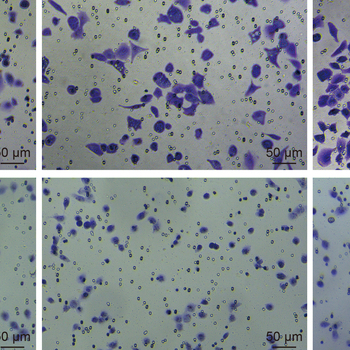 Mechanism of OTUD5 in non‐small cell lung cancer cell proliferation, invasion, and migration