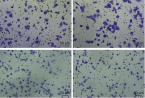 Mechanism of OTUD5 in non‐small cell lung cancer